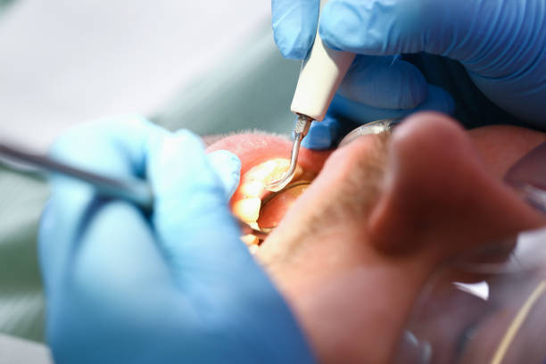 Best After-Hours Dental Care in Elkton, VA