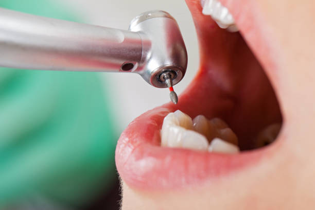 Best Walk-In Emergency Dental Services in Elkton, VA